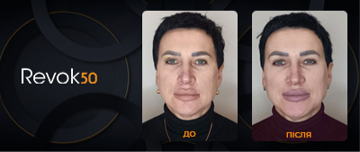 До-Після 10